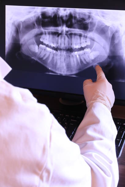 Best Emergency Dental Extractions in Stockbridge, MI