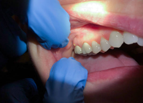 Best Weekend Emergency Dentist in Stockbridge, MI