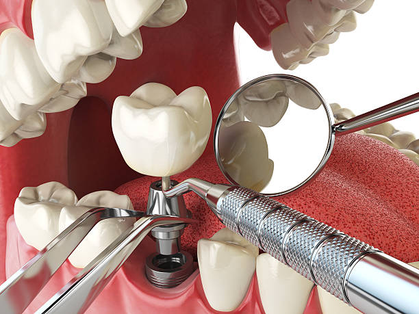 Best Broken or Cracked Tooth Emergency Dentist in Stockbridge, MI